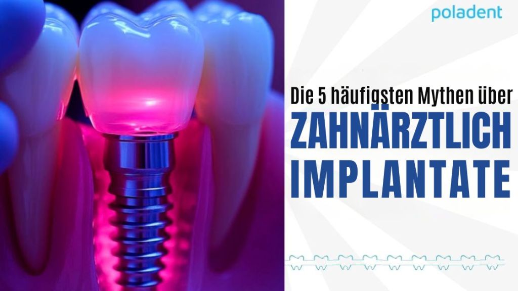 Die 5 häufigsten Mythen über Zahnimplantate