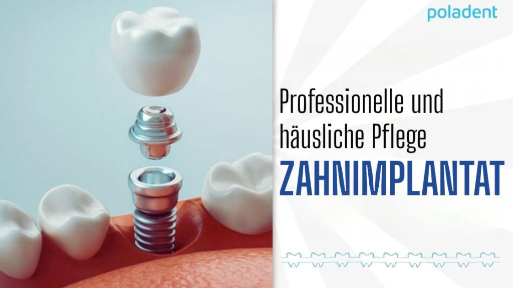 Professionelle und häusliche Zahnimplantatpflege