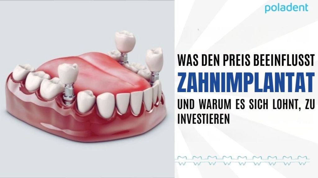 Was den Preis eines Zahnimplantats beeinflusst – und warum es sich als Investition lohnt.