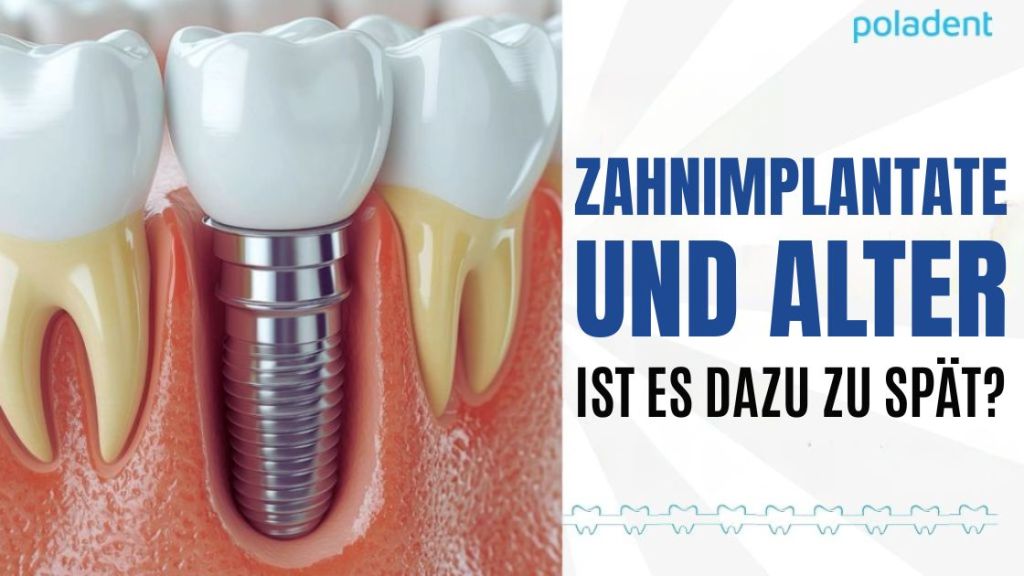 Zahnimplantate und Alter: Ist es zu spät?