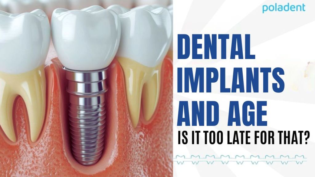 Dental Implants and Age: Is It Too Late?