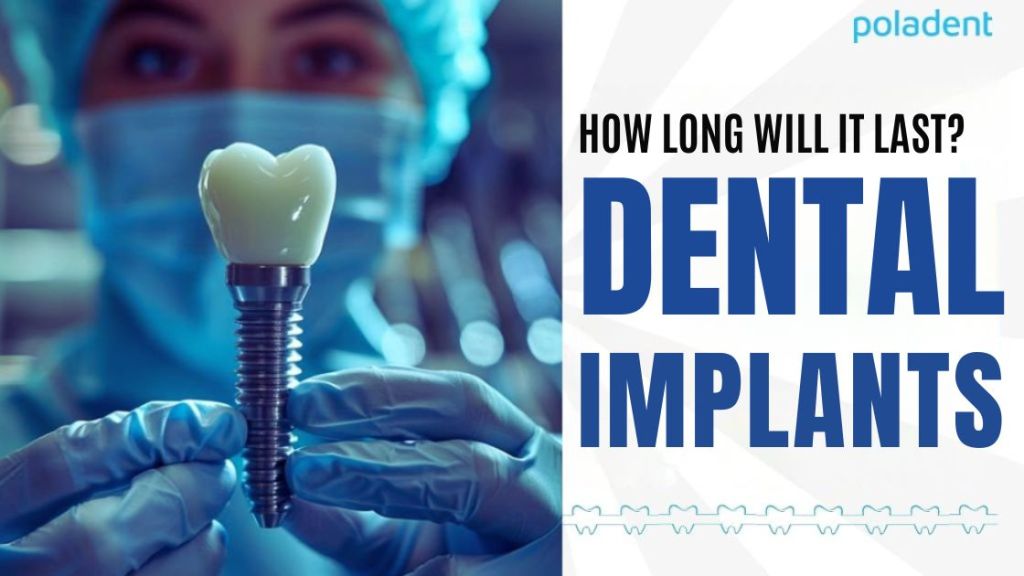 How long do dental implants last?