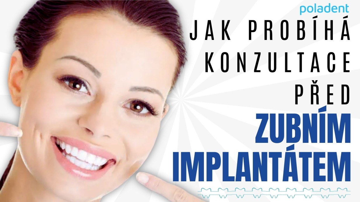 Jak probíhá konzultace před zubním implantátem