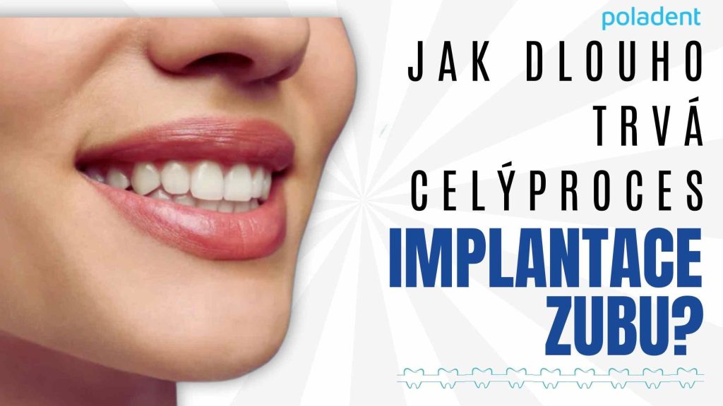 Jak dlouho trvá celý proces implantace zubu
