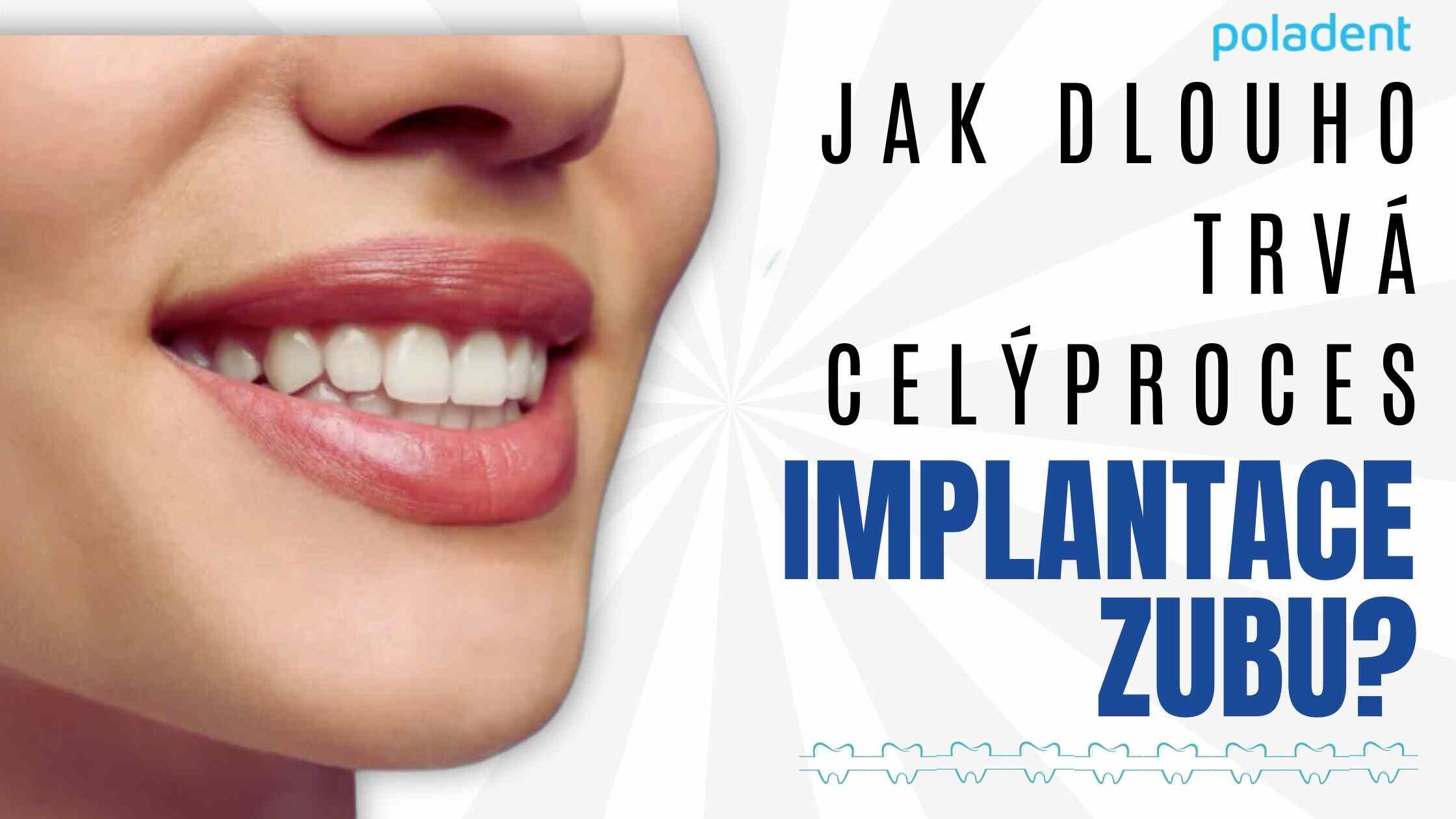Zubní implantát: postup implantace