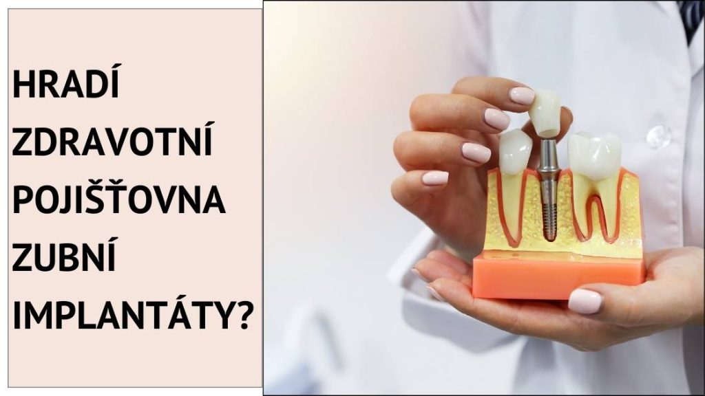 Hradí zdravotní pojišťovna zubní implantáty