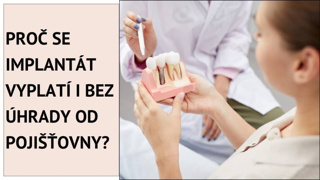 Proč se implantát vyplatí i bez úhrady od pojišťovny